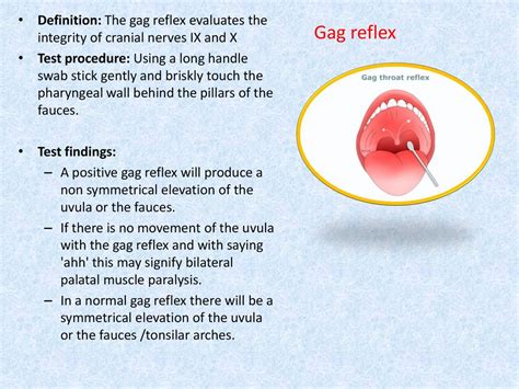 no gag reflex|Gag reflex: Definition, causes, and how to control it